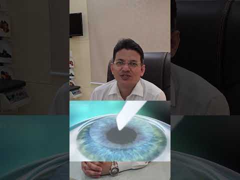 PRK Laser Treatment || PRK vs LASIK Laser || PRK Procedure fitness || Dr. Shakeel Ahmad