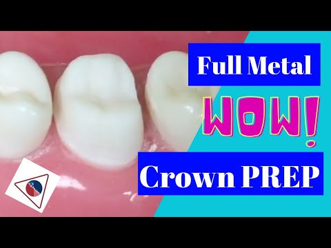 Crown Preparation in Three Steps (Tutorial) | In Office to Hands On Dental Training
