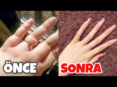 FINGER SLIMMING METHODS AT HOME 🖐🏼 FINGER SLIMMING MOVEMENTS