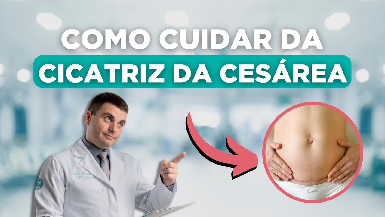 Como Cuidar da Cicatriz da Cesariana?