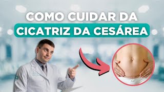 Como Cuidar da Cicatriz da Cesariana?