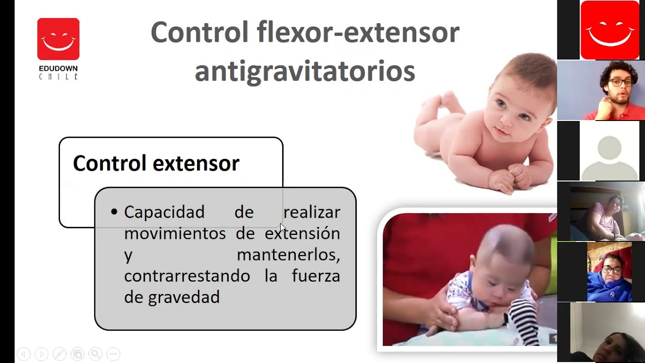 Importancia del control flexor en bebes con síndrome de Down