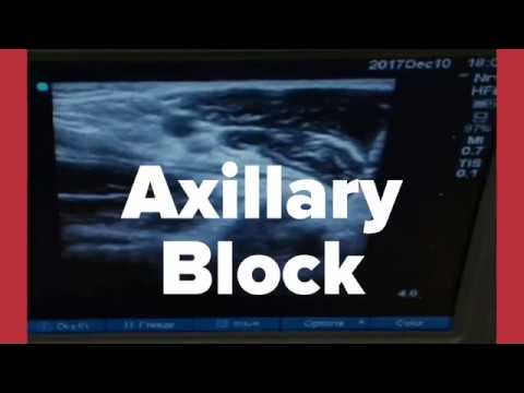Axillary Block