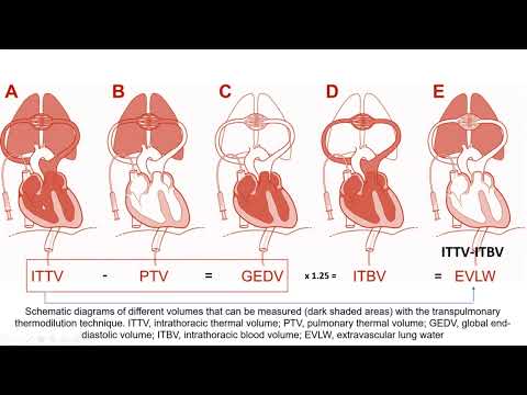 Transpulmonary Thermodilution method: Case studies