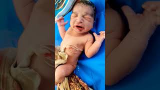 First cry immediately after birth of a very cute Newborn Baby #shorts