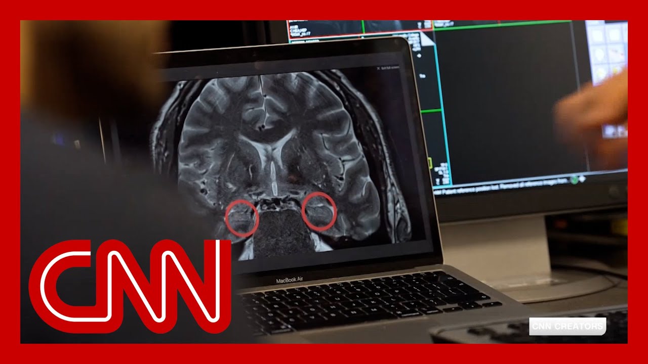 Hear why Alzheimer’s researchers are studying the brains of London cab drivers