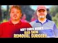 1000-Lb Sisters The Truth Behind Chris Combs' Skin Removal Decision