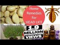 Top 5 Home Remedies To Get Rid Of Head LICE & Nits * Sushmita's Diaries