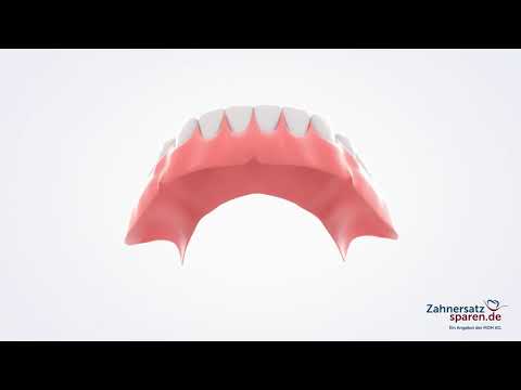 Behandlungsablauf: Vollprothese - Zahnersatzsparen.de