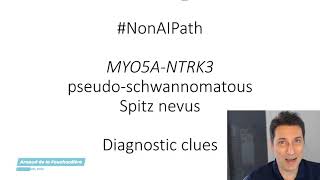 MYO5A-NTRK3 pseudo-schwannomatous Spitz nevus: morphological clues in the #NonAIpath project