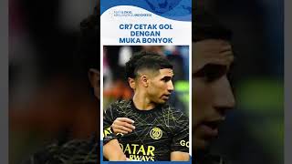 Ronaldo Kena Tinju Kiper PSG saat Debut di Arab Saudi, CR7 Tetap Cetak Gol Meski Muka Bonyok