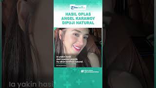 Potret Terbaru Angel Karamoy: Operasi Plastik Sukses, Dipuji Netizen!
