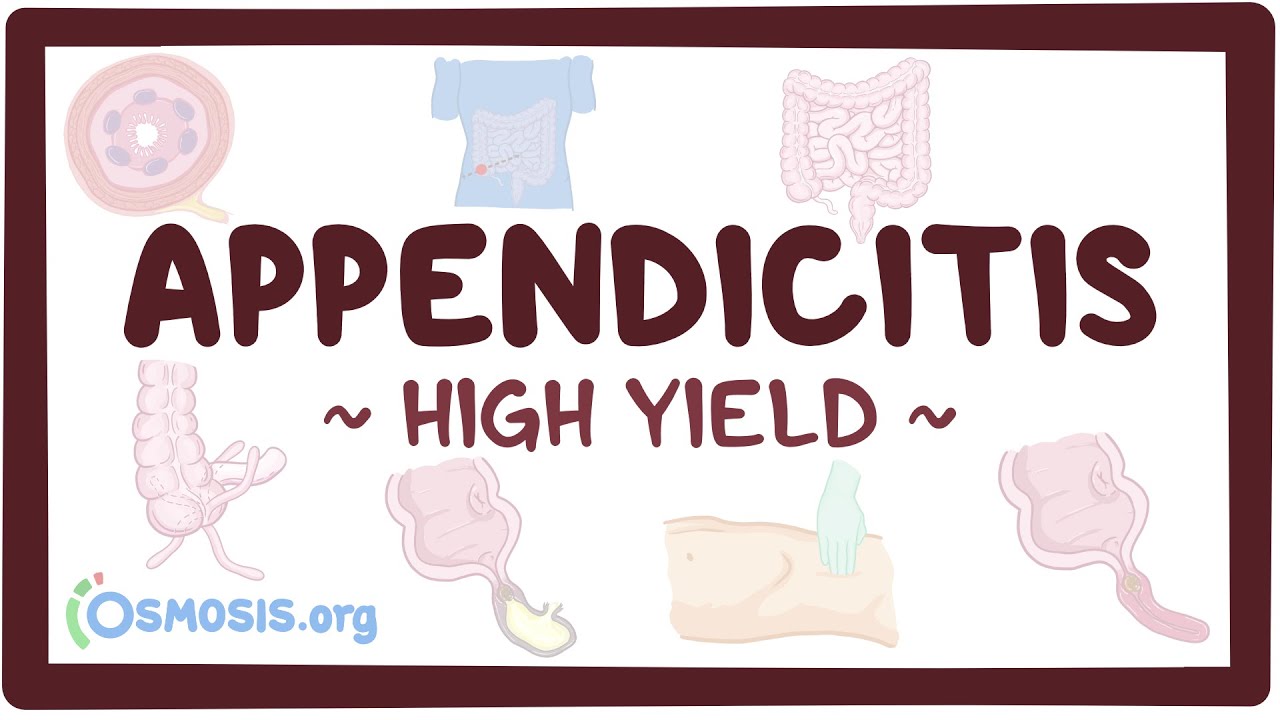 Appendicitis: Pathology review