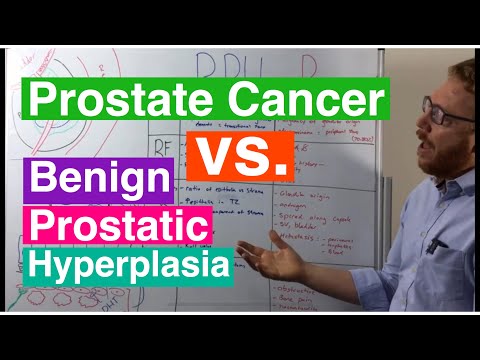 Prostatitis and elevated psa