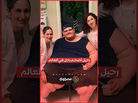 وزنه تجاوز نصف الطن.. رحيل "بيدرو فرانكو" أضخم رجل في العالم 