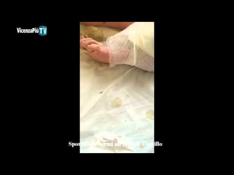 Trattamento di vermi a bambini circa un anno Come combattere contro vermi a