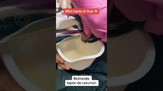 Download lagu Lavado de oidos realizado por profesionales de la salud CERTIFICADOS y con EXPERIENCIA🫡 Cefes.cl2 mp3 Download lagu Lavado de oidos realizado por profesionales de la salud CERTIFICADOS y con EXPERIENCIA🫡 Cefes.cl2 mp3