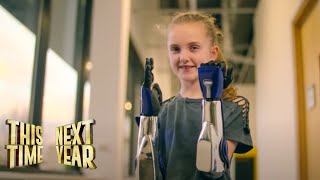 These Customized 3D-Printed Bionic Hands Are Changing Lives