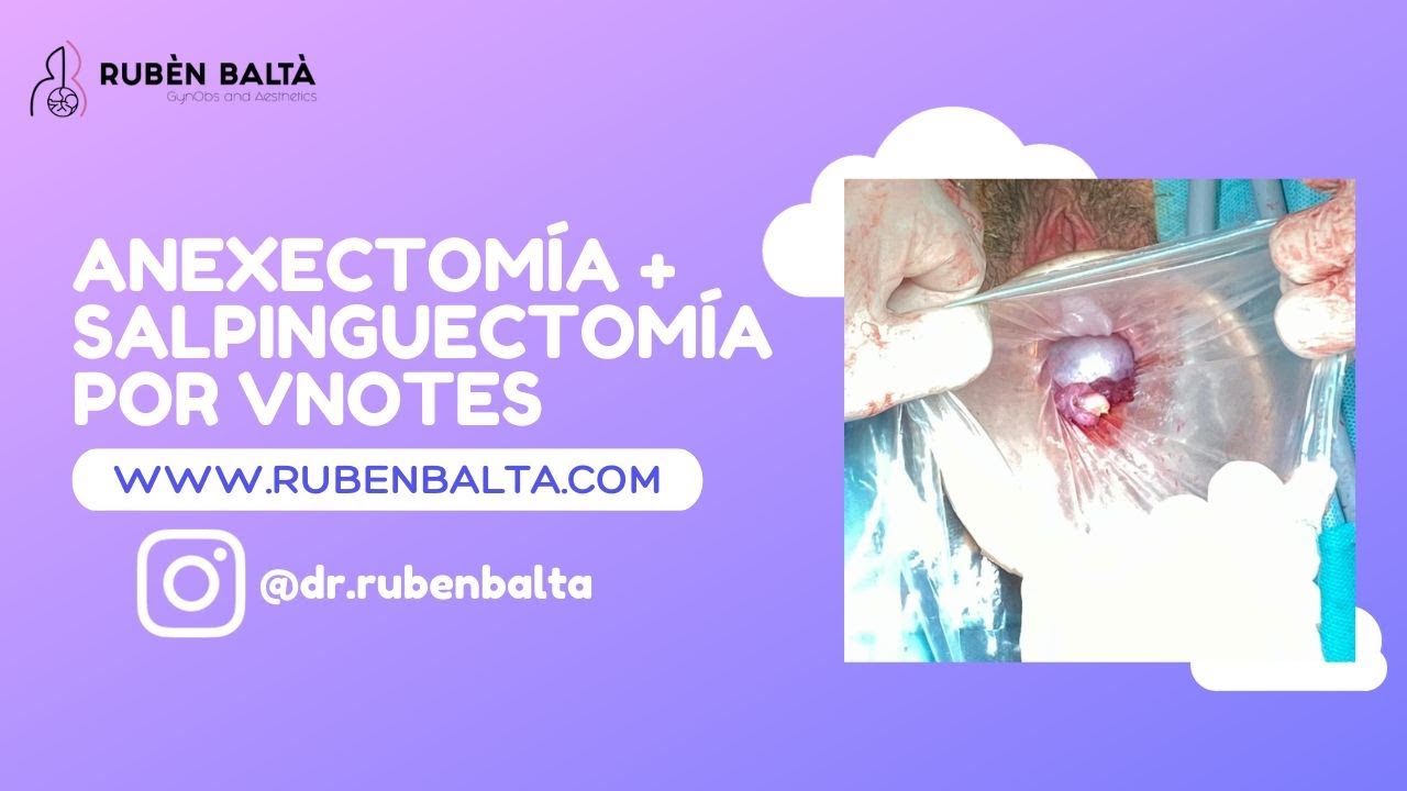 Rubèn Baltà I Arandes-13