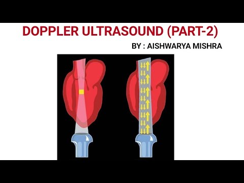 DOPPLER ULTRASOUND (PART-2) || BY: AISHWARYA MISHRA
