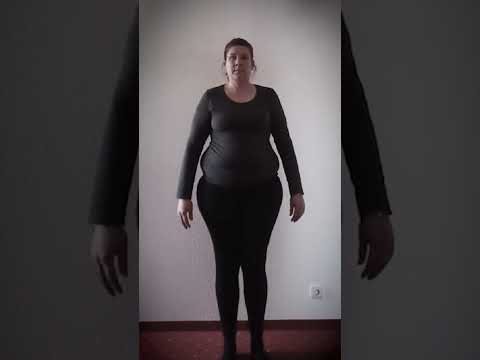 Kerstin hat 32 Kilo abgenommen und fühlt sich endlich wieder richtig wohl🙏