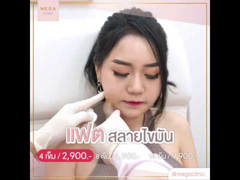 เมโสแฟต ยี่ห้อไหนดี