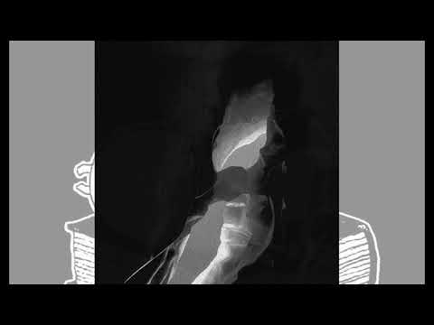 Apoxupon - Nameless and Formless - full album (2021)