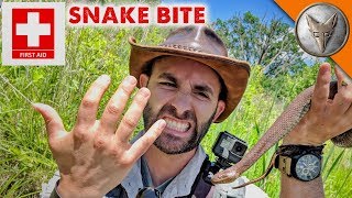 Snake Bite First-Aid