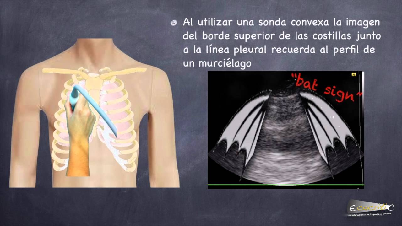 ECO PULMONAR