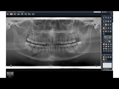 Morita i Dixel SCOUT 2D desde Panoramica