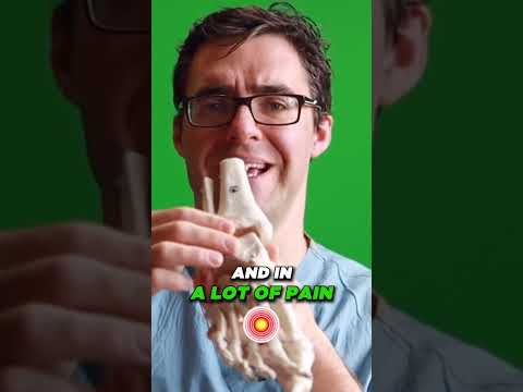 Why Is My Sprained Ankle Still Swollen After 3 6 or 12 MONTHS