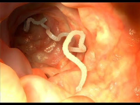 sejur detoxifiere turcia
