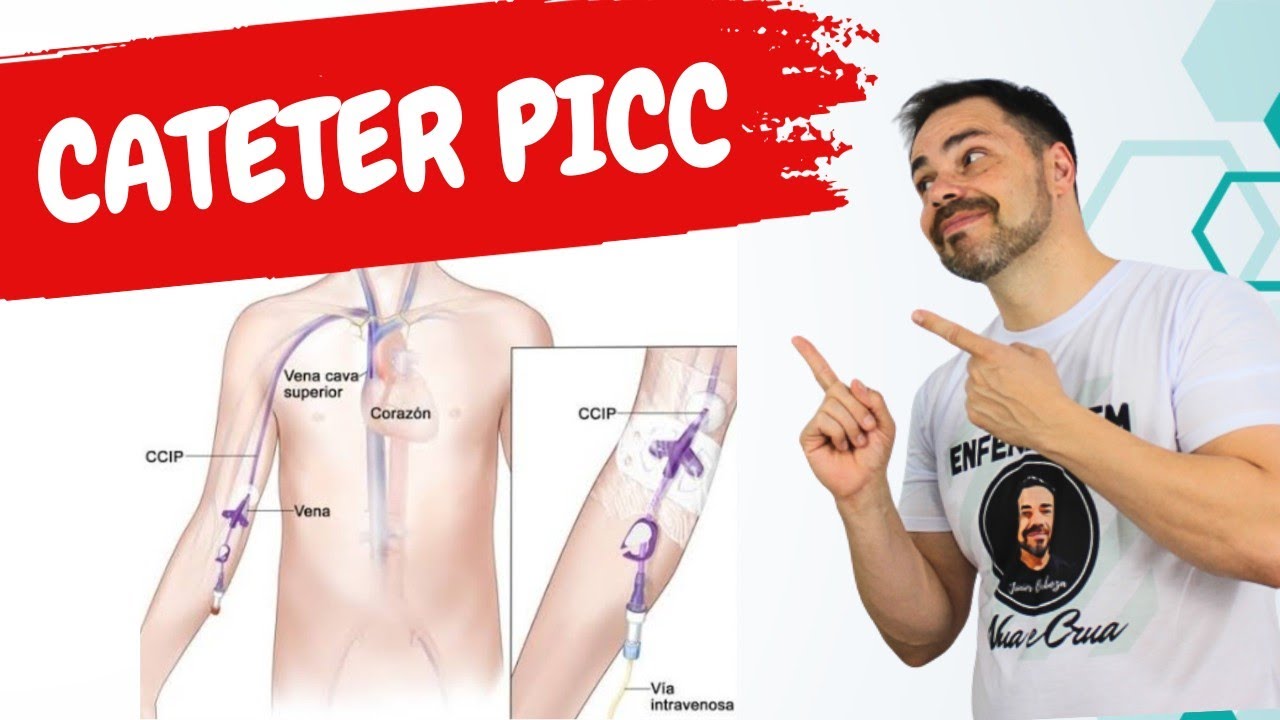 CATETER PICC - Não pode ficar sem ver este vídeo