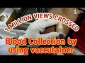 Blood collection by using vaccutainer method.closed system of blood collection.