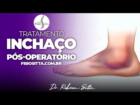 EDEMA SWELLING POST TRAUMA FRACTURE IMMOBILIZATION CONTUSION Dr. Robson Sitta Physiotherapy Clinic