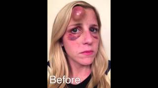 MASSIVE Goose Egg Drained