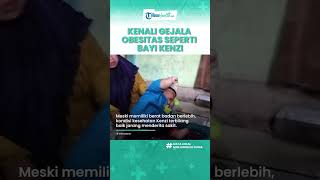 Viral Bayi Usia 16 Bulan di Bekasi Alami Obesitas 27 Kilogram, Berikut Penyebab Diabetes