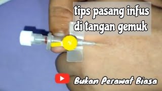 Download lagu cara pasang infus di tangan gemuk Vena bercabang dan ga terlihat mp3 Download lagu cara pasang infus di tangan gemuk Vena bercabang dan ga terlihat mp3