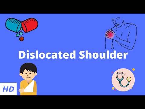 Dislocated Shoulder, Causes, Signs and Symptoms, Diagnosis and Treatment.