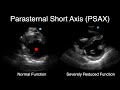 POCUS Visually Estimating Cardiac Function