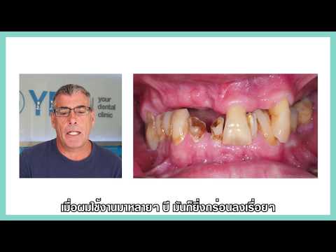 ยกทรงกีฬาสำหรับหน้าอกเล็ก การออกกำลังกายเพิ่มหน้าอก