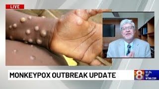 Doctor gives an update on the monkeypox outbreak in the U.S.