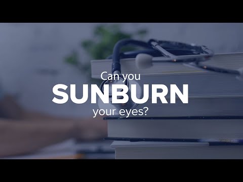 Expert Insights: Can you sunburn your eyes?