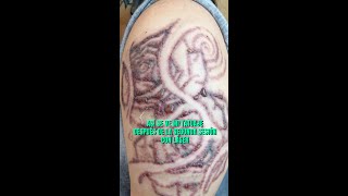 Resultado segunda sesión para ELIMINAR mi TATUAJE con láser 🔥