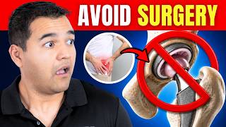 Top 4 Exercises to Delay And Even Avoid A Hip Replacement Surgery