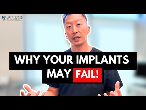 Dental Implant Failure: How Gums and Bone Impact Success!