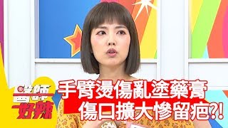 阿諾手臂燙傷亂塗藥膏！傷口擴大慘留疤？！【醫師好辣】 20190618  part3  EP759 田知學 阿諾