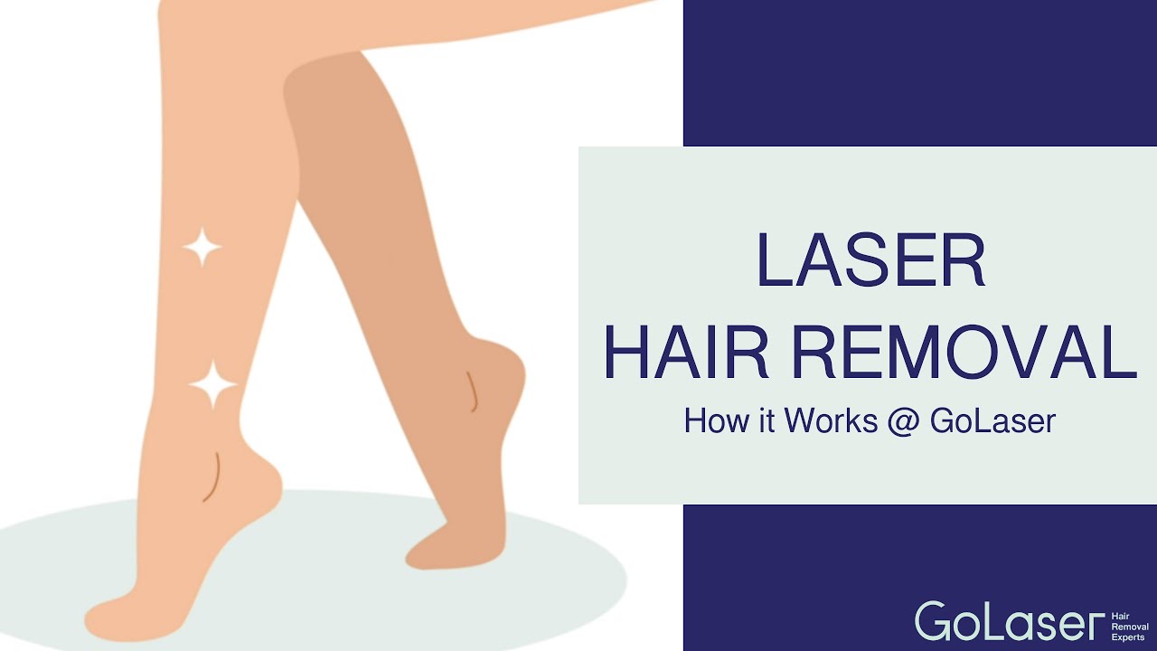 Laser Hair Removal - How it Works - GoLaser