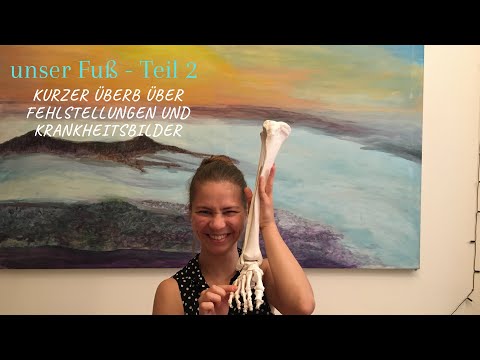 Ein Überblick über Fußfehlstellungen und anderen möglichen Krankheitsbildern - unser Fuß Teil 2