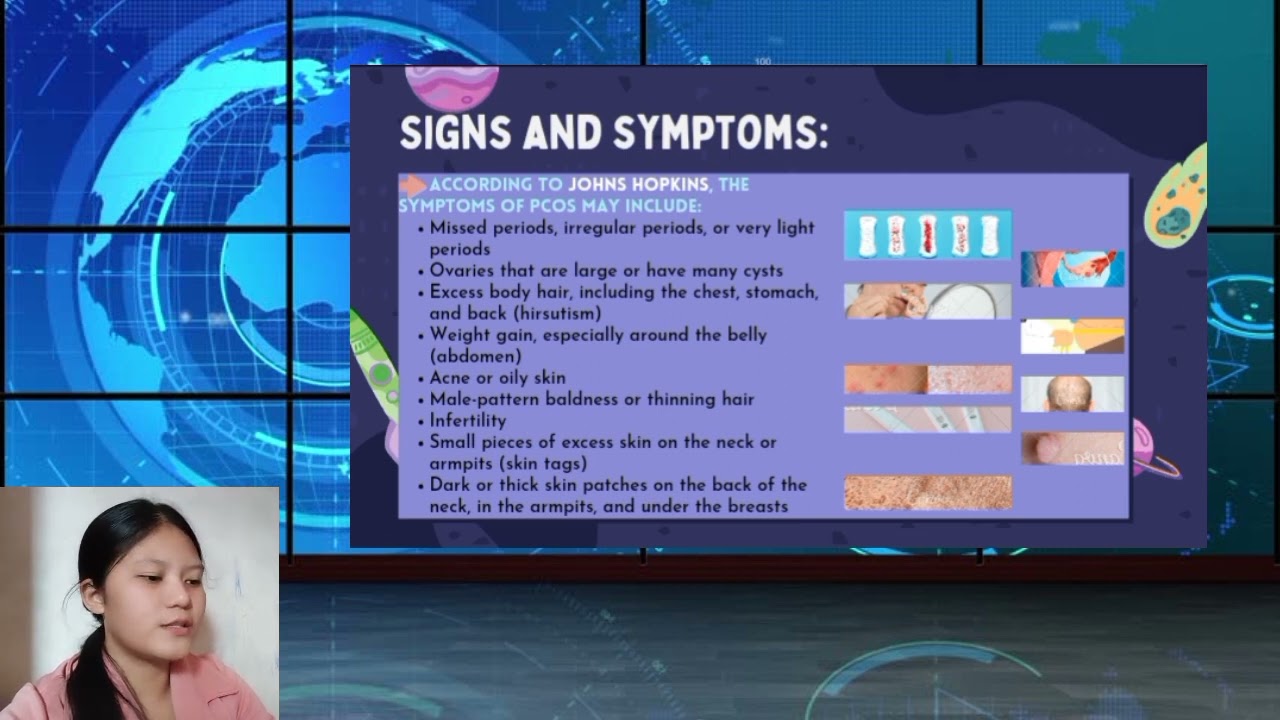 BROADCASTING (HORMONAL DISORDER) PERFORMANCE TASK IN SCIENCE 3RD QUARTER GRADE 10 | janine dionarce